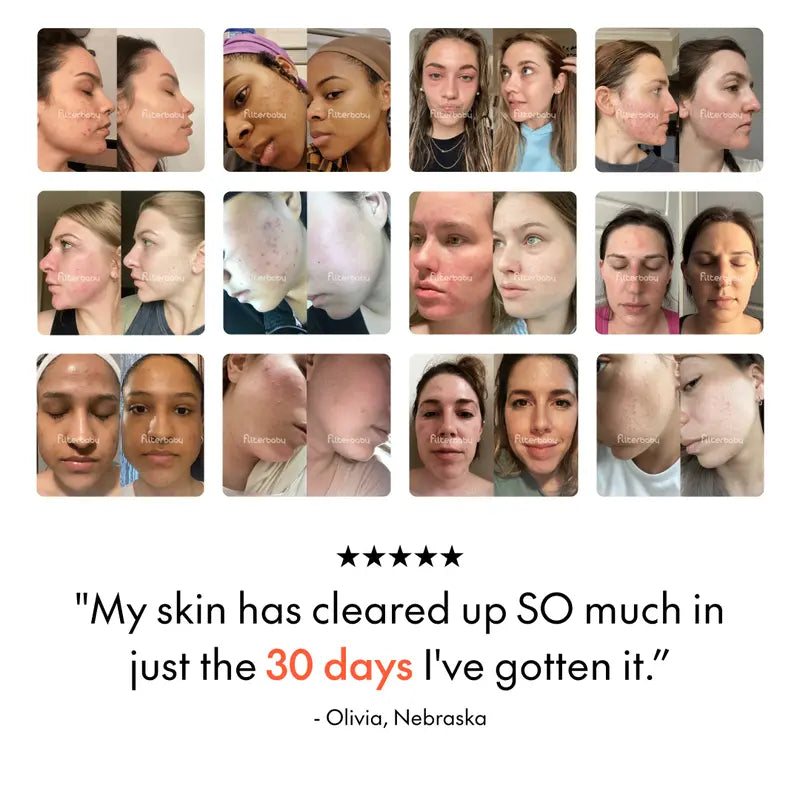 Filterbaby Skincare Filter 2.0 – Dermatologist-Approved Water Purifier