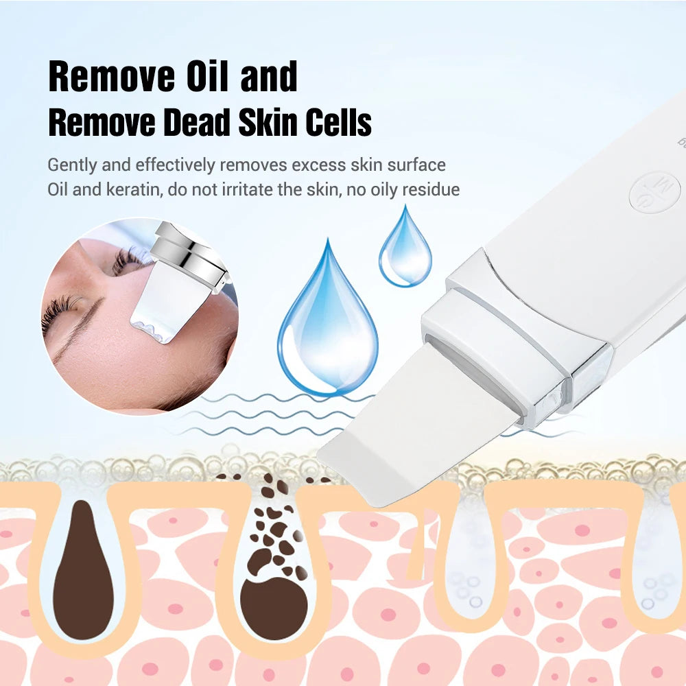 Ultrasonic Skin Scrubber β Blackhead & Pore Cleaner