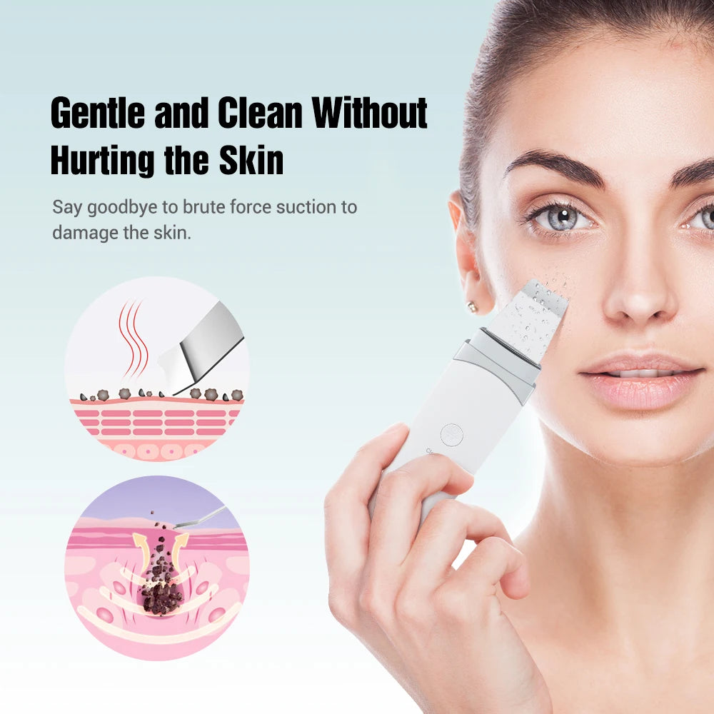 Ultrasonic Skin Scrubber β Blackhead & Pore Cleaner