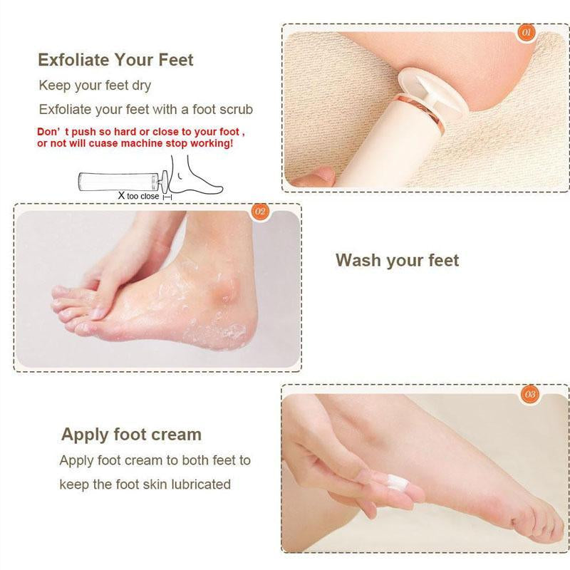 Rechargeable Electric Foot File – Professional Tool for Smooth & Soft Feet